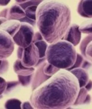 Επιστήμονες δημιουργούν ανοσοκύτταρα που καταπολεμούν τον καρκίνο απευθείας στο σώμα