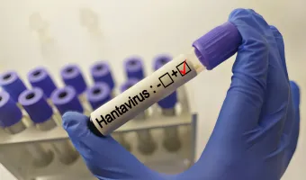 hantavirus test