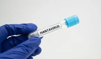 Hantavirus test