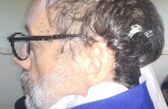 Κουκάκι: Ο Ραγκούσης δημοσιοποιεί φωτογραφίες που δείχνουν τον σκηνοθέτη τραυματισμένο