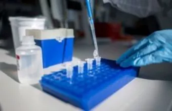 Κορωνοϊός: Η ελληνική ανακάλυψη - ελπίδα για τους βαριά ασθενείς