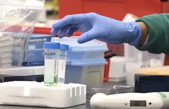 Γερμανία: Ένα γρήγορο και αξιόπιστο τεστ για τον κορωνοϊό θα κυκλοφορήσει από Απρίλιο