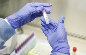 Τις μεταλλάξεις του κορωνοϊού θα ανιχνεύει το Εργαστήριο Κλινικής Ιολογίας του Πανεπιστημίου Κρήτης  