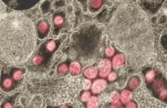 Πόσο επιβιώνει ο κορωνοϊός στο ανθρώπινο δέρμα και πόσο γρήγορα εξουδετερώνεται 