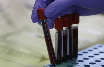 Οι ειδικοί τονίζουν: Δεν σχετίζεται ο αυτισμός με το αντιγριπικό εμβόλιο στην εγκυμοσύνη