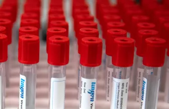 ΗΠΑ - κορωνοϊός: Αύριο Τρίτη οι πρώτες παραλαβές του εμβολίου της Johnson & Johnson