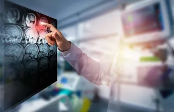 Εγκεφαλικό