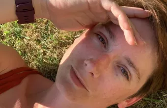 Αυτό είναι το 39χρονο μοντέλο που «έσβησε» από θρόμβωση στην Κύπρο (PICS)