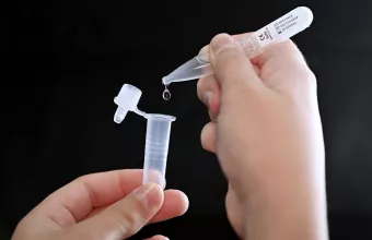 Χάρτης κορωνοϊού - Ελλάδα:  419 κρούσματα σε Αττική, 390 Θεσσαλονίκη, 144 Λάρισα  (Λίστα) 