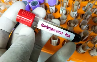 ΠΟΥ για ευλογιά των πιθήκων: Δεν υπάρχουν στοιχεία ότι ο ιός έχει μεταλλαχθεί