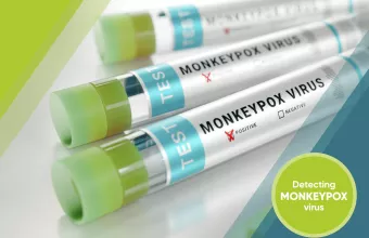 Ύποπτο κρούσμα ευλογιάς των πιθήκων στην Ελλάδα