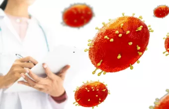 Ευλογιά των πιθήκων