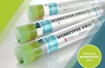 Ευλογιά των πιθήκων: Πάνω από 50.000 κρούσματα σε όλον τον κόσμο