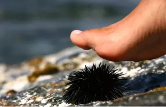 Τι να κάνετε αν πατήσετε αχινό