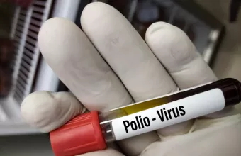 Δοκιμαστικός σωλήνας πολιομυελίτιδας