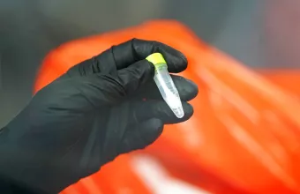 Ευλογιά των Πιθήκων