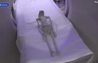 εξωγιηνοι μεξικο