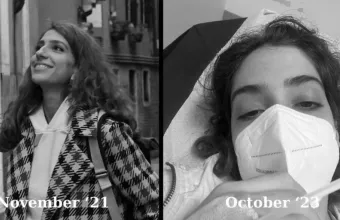 Σύνδρομο Long Covid