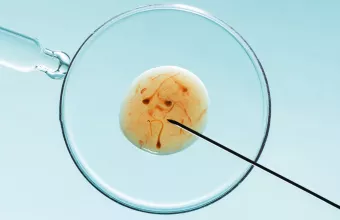 εξωσωματικη γονιμοποιηση