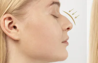 Μύτη διόρθωση με μακιγιάζ