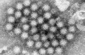 Norovirus
