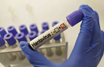 hantavirus test