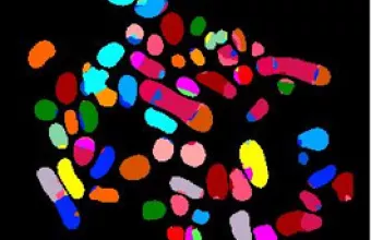 Ανδρικός καρκίνος του μαστού: Ένας χρήσιμος οδηγός 