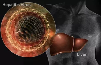 O ιός της Ηπατίτιδας- Στα εννέα έφτασαν τα ύποπτα κρούσματα σε παιδιά στην Ελλάδα 