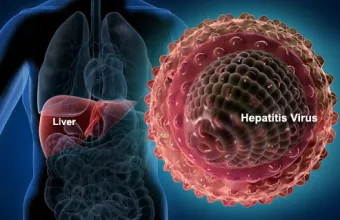 Επισήμως τρία κρούσματα οξείας ηπατίτιδας στην Ελλάδα - Δηλώθηκαν στο ECDC