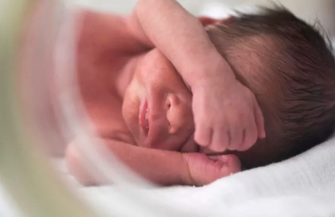 Η γέννηση ενός μωρού χωρίς πρόσωπο συνταράσσει την Πορτογαλία