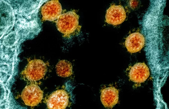 Πώς τα T-λεμφοκύτταρα θα μπορούσαν να ενισχύσουν την ανοσία έναντι του κορωνοϊού
