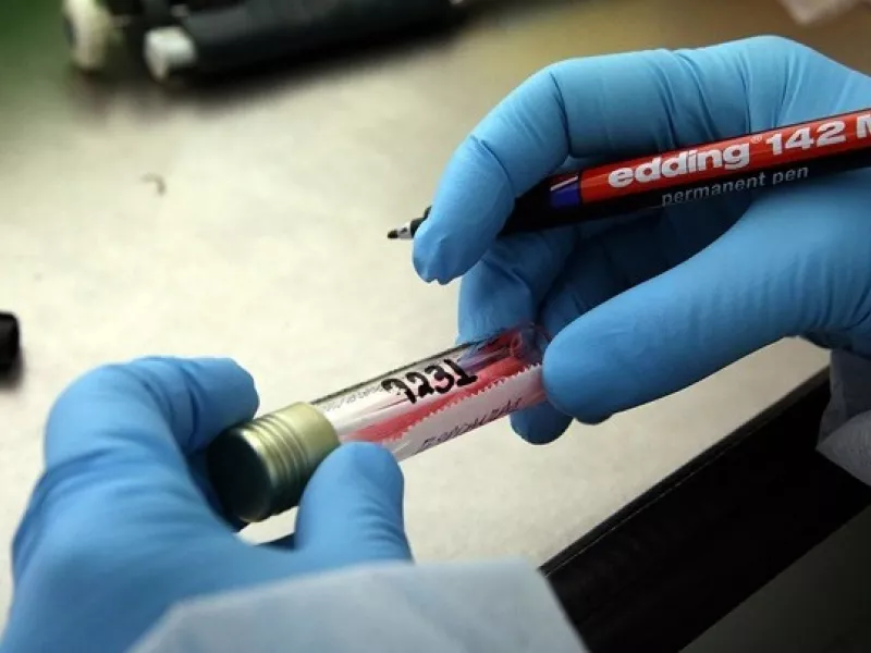 Μεταλλάξεις Κορωνοϊού: Στο 62,3% η βρετανική μετάλλαξη στην Ελλάδα -Σε ποιες περιοχές εντοπίζεται