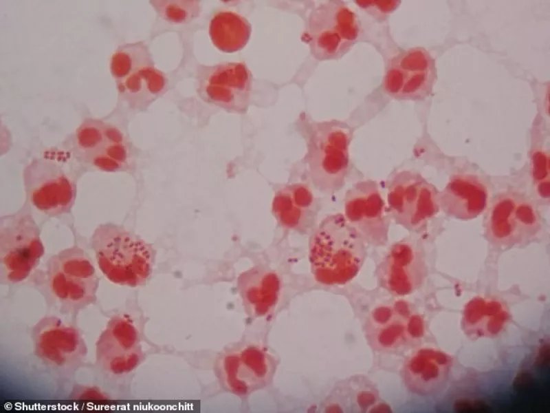 Φόβοι από νέο στέλεχος γονόρροιας: Για «μείζονα παγκόσμια απειλή» μιλάνε γιατροί 