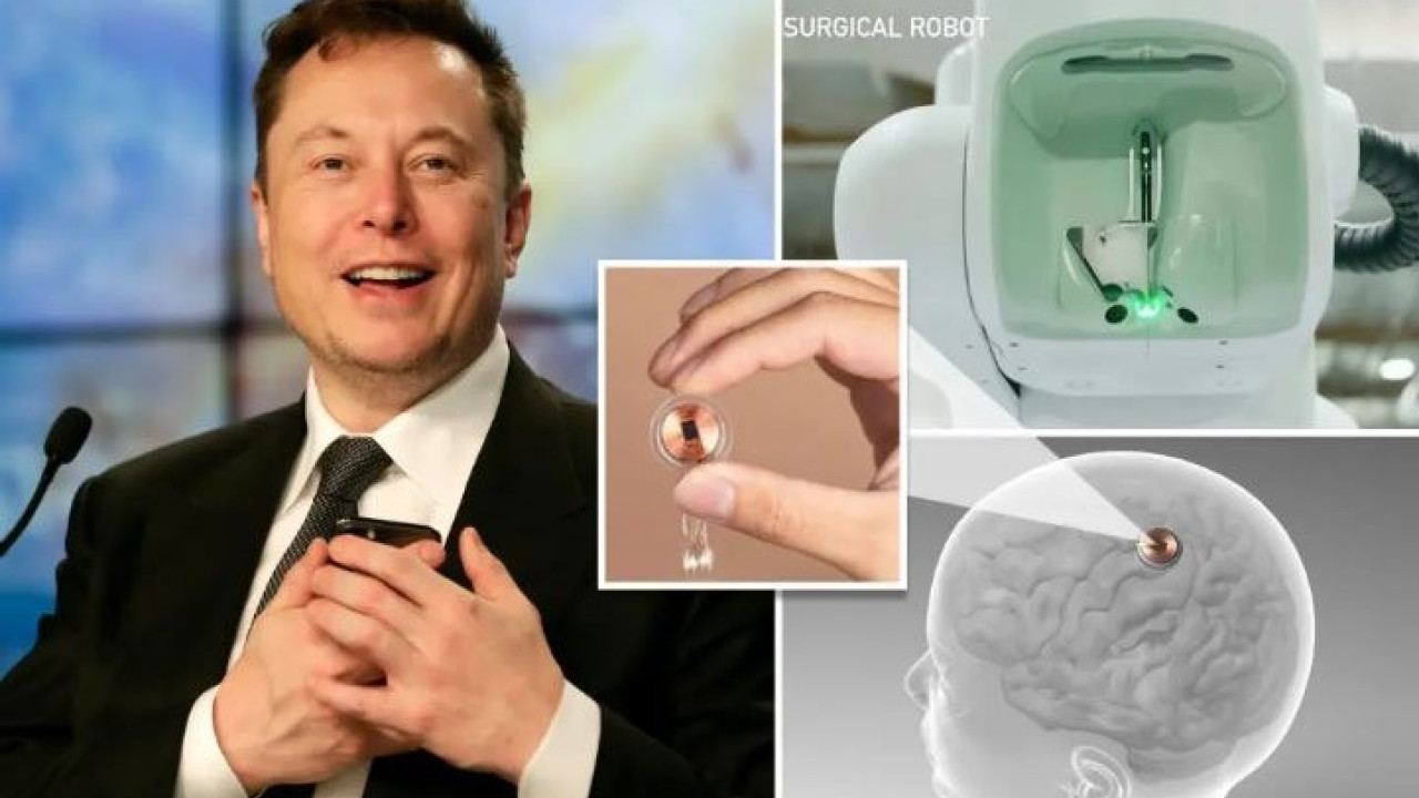 Elon Musk: Ανακοίνωσε την πρώτη επιτυχημένη εμφύτευση ασύρματου τσιπ σε ανθρώπινο εγκέφαλο - Δείτε video