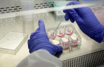 Κορωνοϊός: Ελπιδοφόρα γερμανική έρευνα - Πώς θα σταματούν την εξάπλωση του ιού στο σώμα