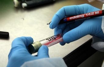 Πώς σχετίζεται ο κορωνοϊός με την ομάδα αίματος- Μειωμένος κίνδυνος για όσους έχουν ομάδα αίματος 0 