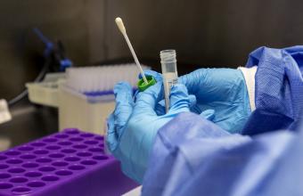 ΗΠΑ: Η FDA ενέκρινε το πρώτο γρήγορο τεστ κορωνοϊού - Αποτελέσματα σε 30 λεπτά