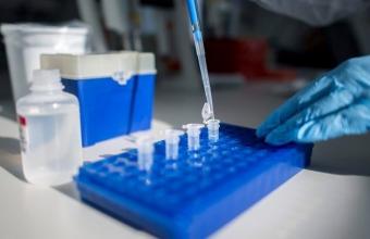 Κορωνοϊός: Ξεκίνησε η μελέτη του ΕΚΠΑ για την ανάπτυξη εξουδετερωτικών αντισωμάτων από τα εμβόλια