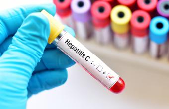 Oξεία ηπατίτιδα σε παιδιά: Δεν είναι μεγάλος ο κίνδυνος λέει ο Μόσιαλος - Τα τελευταία δεδομένα