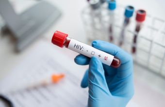 Ανακαλύφθηκε στην Ευρώπη νέα, πιο παθογόνα και μεταδοτική, παραλλαγή του ιού HIV του AIDS