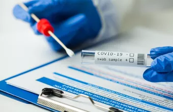 Κορωνοϊός: Ένα νέο μοριακό τεστ PCR ειδικά για τη μετάλλαξη Όμικρον ανέπτυξαν ερευνητές 