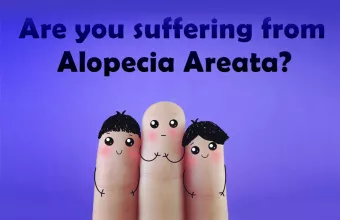 Γυροειδής αλωπεκία ή τριχοφάγος: Αίτια, συμπτώματα και αντιμετώπιση