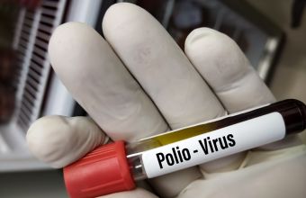 Εντοπίστηκε ο ιός της πολυομυελίτιδας στα λύματα του Λονδίνου