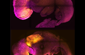 Συνθετικό έμβρυο ποντικιού, με εγκέφαλο και καρδιά που χτυπά, δημιούργηθηκε από βλαστοκύτταρα