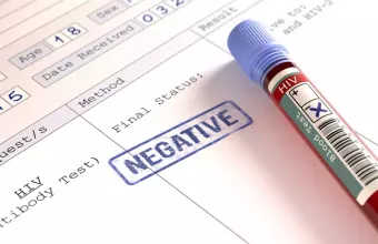 Ιταλία: Δωρεάν για τις γυναίκες το αντισυλληπτικό χάπι και η θεραπεία για τον HIV