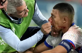 Mbappe