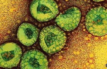 Μπέρδεμα με το όνομα του κορωνοϊού: SARS-CoV-2 ο ιός, Covid-19 η νόσος
