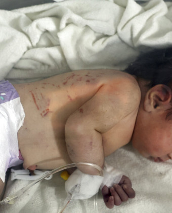 Φονικοί σεισμοί- Συρία: Σε θερμοκοιτίδα το μωρό που γεννήθηκε σε ερείπια
