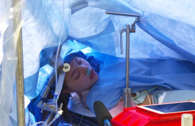 Γιατροί έκαναν εγχείριση εγκεφάλου σε ζωντανή μετάδοση μέσω Facebook