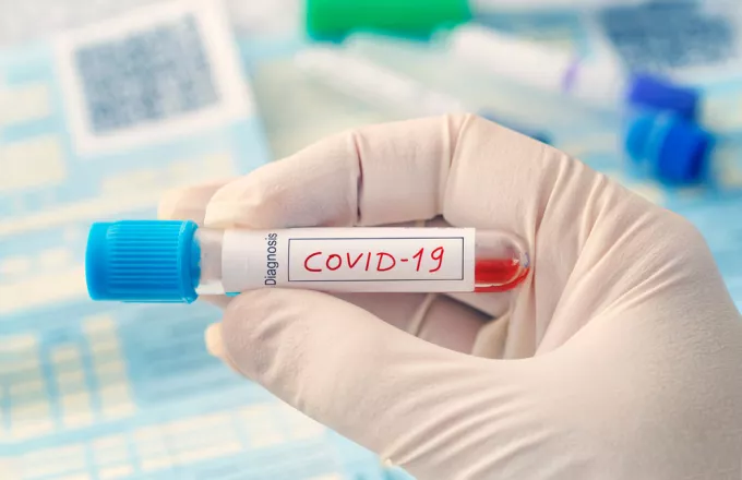 Ανοσία μετά από λοίμωξη COVID-19: Ανεπαρκή δεδομένα και αναπάντητα ερωτήματα